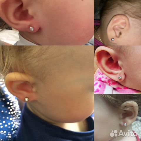 Прокол ушей детям, система 75 Прокол ушей детям, система 75