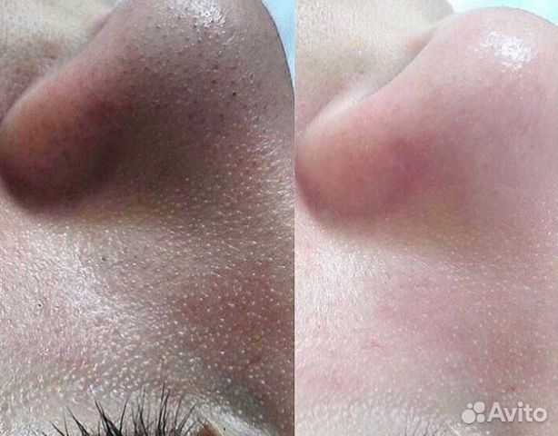 Косметолог эстетист Косметолог эстетист