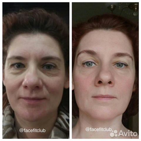 Фейсфитнес/Массаж лица/Фейслифтинг/Тренер/Пилатес