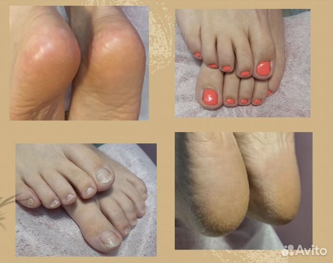 Маникюр Смарт-педикюр Наращивание ногтей