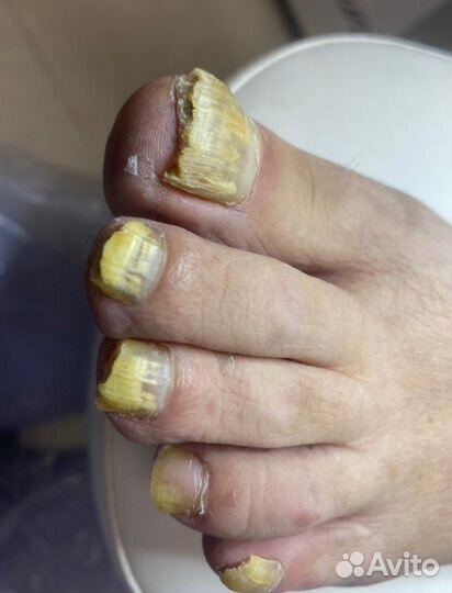 Услуги подолога