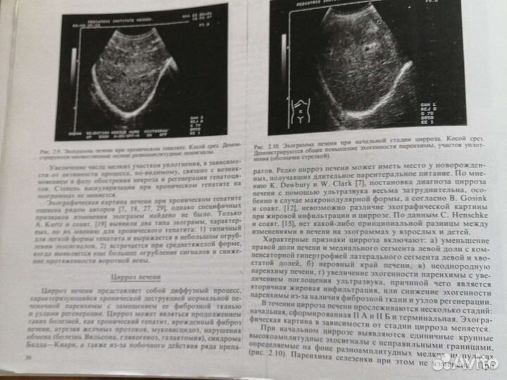 Эхография внутренних органов у детей. Дворяковский