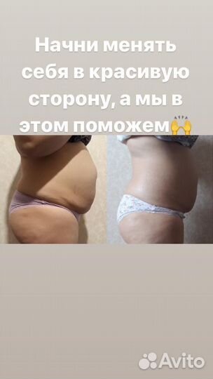 Антицеллюлитный массаж