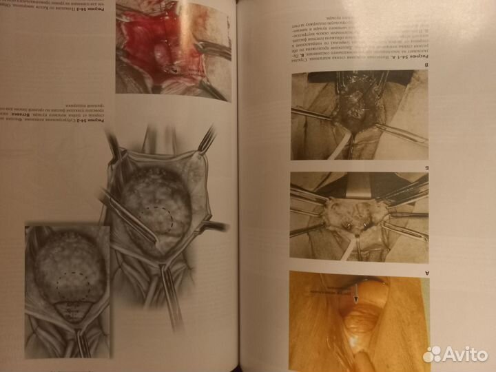 Продам атлас баггиш каррам