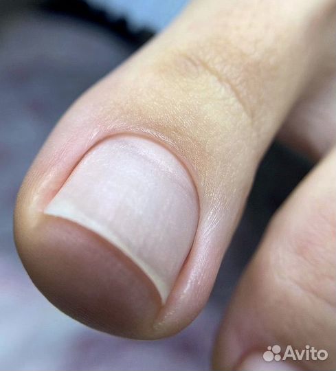 Гигиенический педикюр