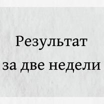 Альтернативная ликвидация ООО, Мытищи