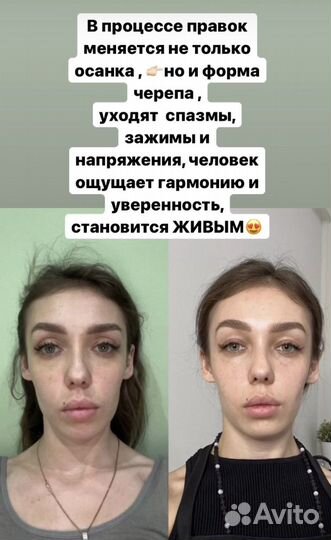 Устраняю боль, исправляю осанку