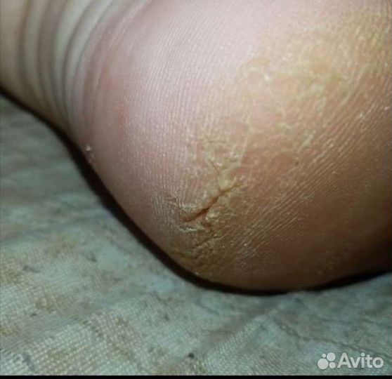 Педикюр с выездом на дом