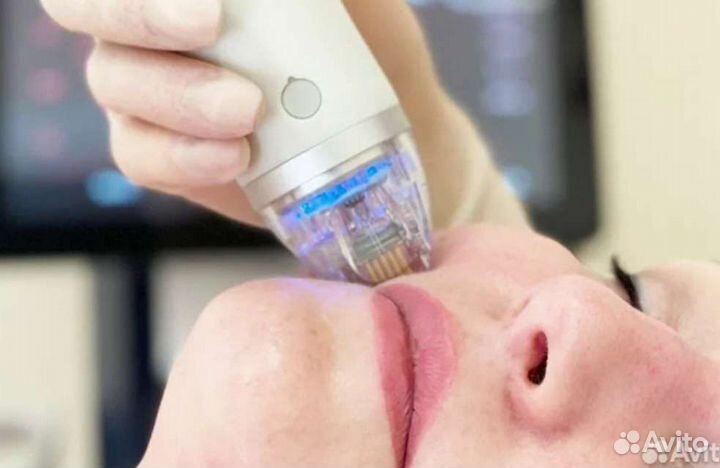 Rf лифтинг микроигольчатый