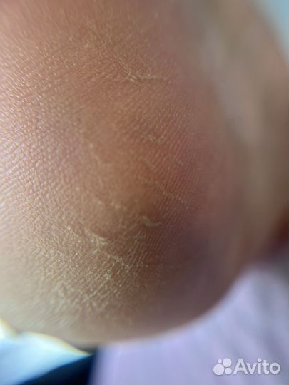 Требуются модели на педикюр