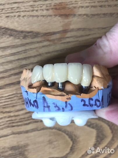 Зубной техник