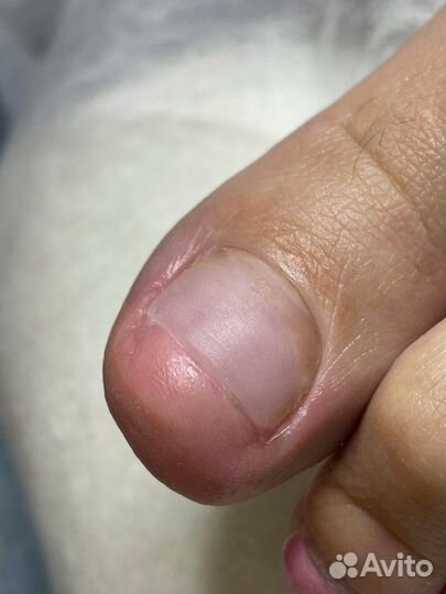 Подология и обучение подологии