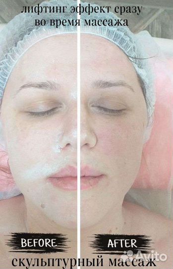 Чистка лица, карбокситерапия