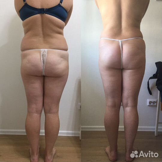 Массаж лица и тела