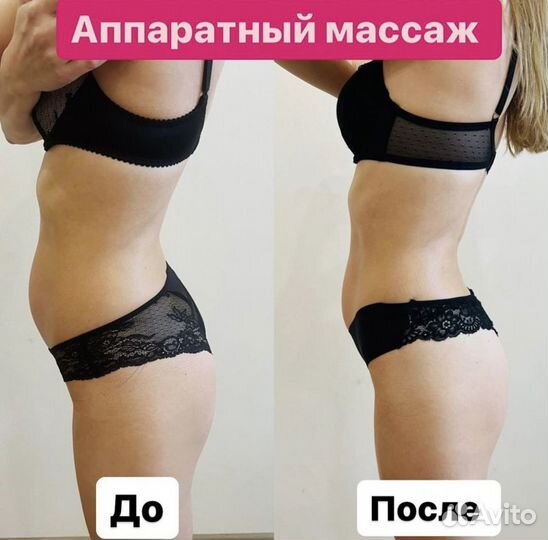 Аппаратный массаж. Антицеллюлитный. Коррекция фигу