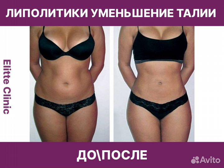 Косметолог худое лицо липолитики