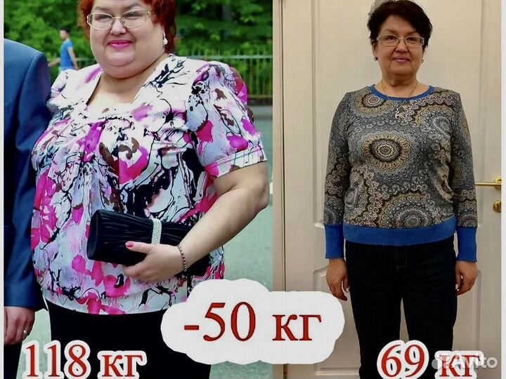 Снижение веса/ Комплексное похудение