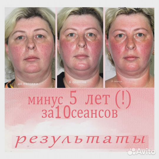 Массаж лица