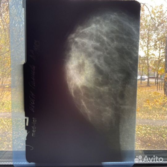 Рентгеновские снимки, маммография набор 8шт