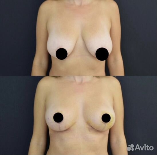 Консультация пластического хирурга