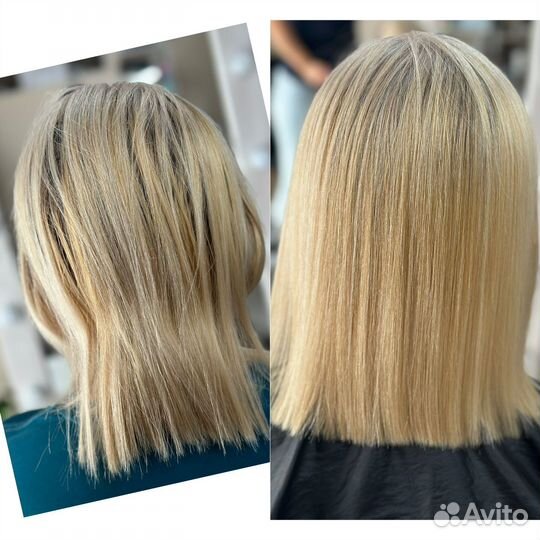 Холодное восстановление, биксипластия