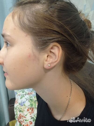 Пирсинг, Прокол мочек ушей, Хрящ, Крыло носа