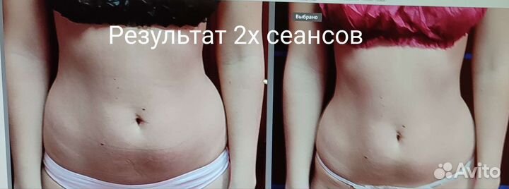 Оздоровительный массаж.Коррекция фигуры. Лицо