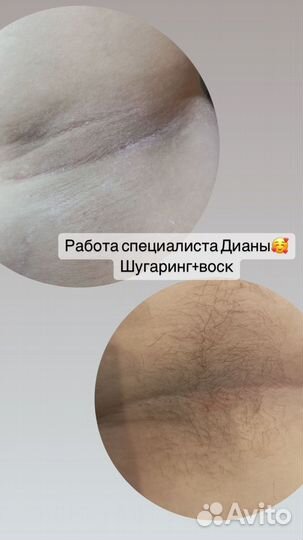 Шугаринг и воск