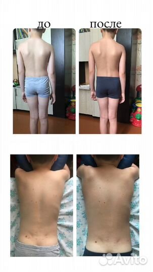 Reset (рисет); Массаж