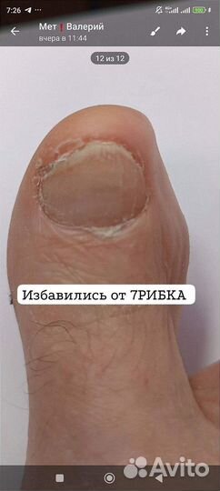 Желудочный сок гюрзы 10%