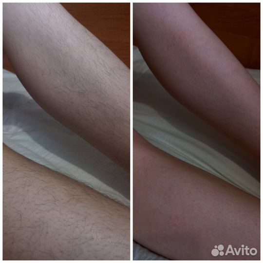 Шугаринг/ваксинг