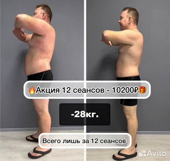 LPG массаж. Коррекция фигуры. Похудение