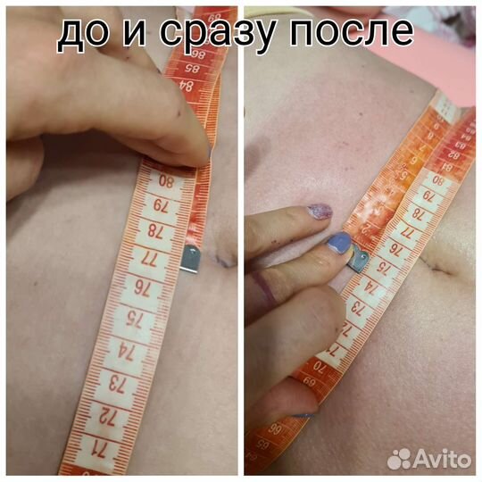 Коррекция Тела, лица Микротоки, кавитация,Вакуум