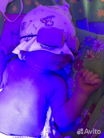 Лампа для лечения желтушки. Фoтoлампа.эффективная