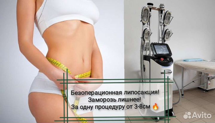 Криолиполиз