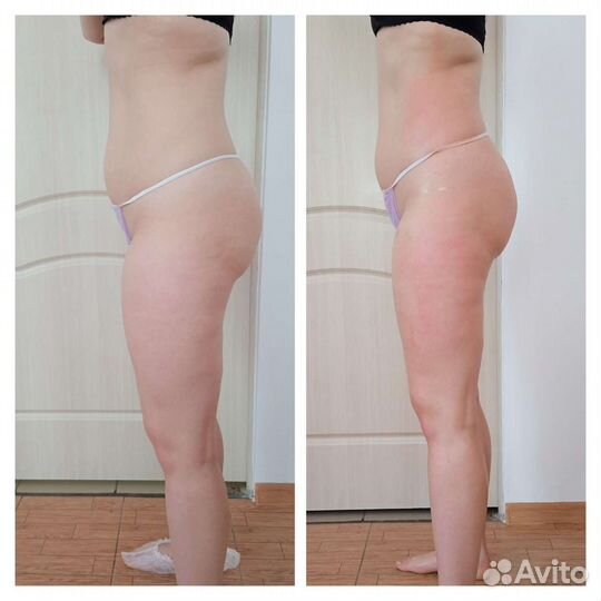 Вакуумный массаж Вибрационный массаж Прессотерапия