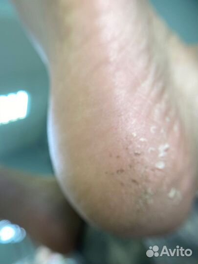 Маникюр, педикюр на дому