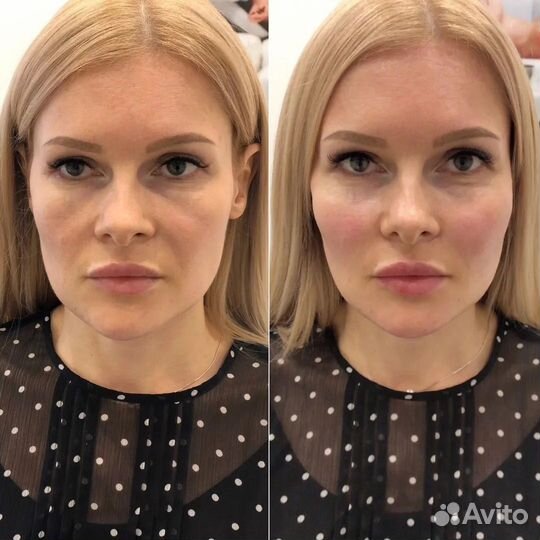 Косметолог лицо под ключ