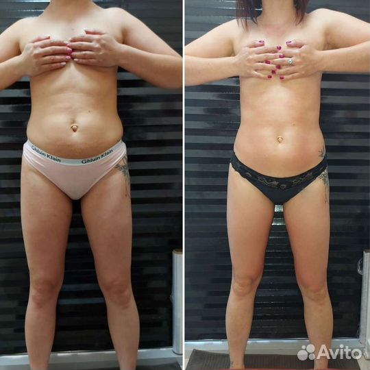 Массаж коррекция фигуры