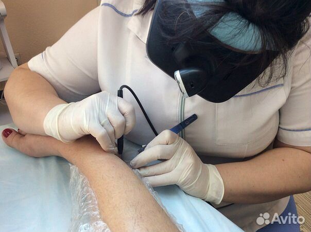 Электроэпиляция для мужчин и женщин