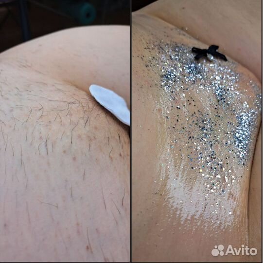 Шугаринг депиляция