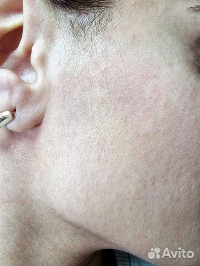 Мастер диодный эпиляции