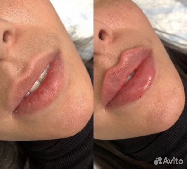 Тренер косметолог обучение модели