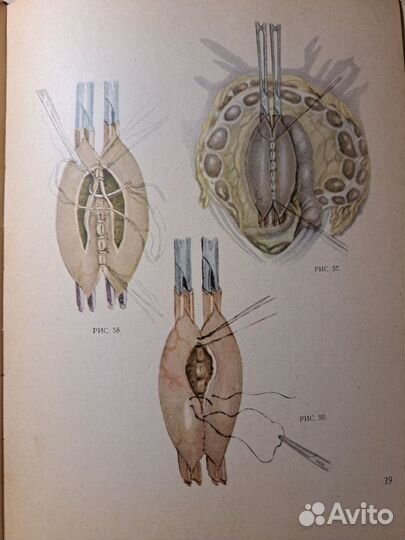 Атлас хирургических операций А.А.Шалимов