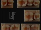 Стоматологические фантомы, модели зубов объявление продам