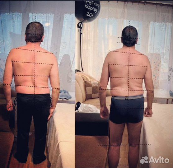 Мануальный массаж (Костоправ )