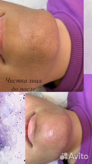 Косметолог эстетист
