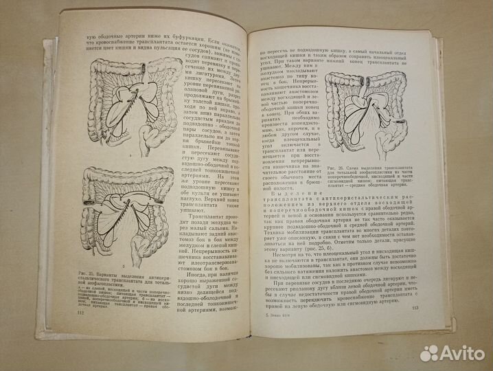 Лечение ожогов и рубцовых сужений пищевода. 1971