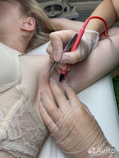 Обучение электроэпиляции и шугарингу/воск