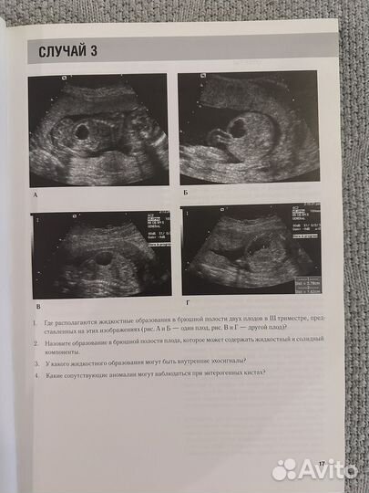 Узи в акушерстве и гинекологии Карен Л. Рейтер